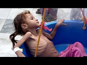 Capturing Yemen’s humanitarian crisis | The Investigators with Diana Swain