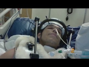 Dr. Max Gomez: Spinal Injury Bypass