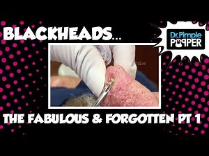 Blackheads : The Fabulous & Forgotten Files, Part One